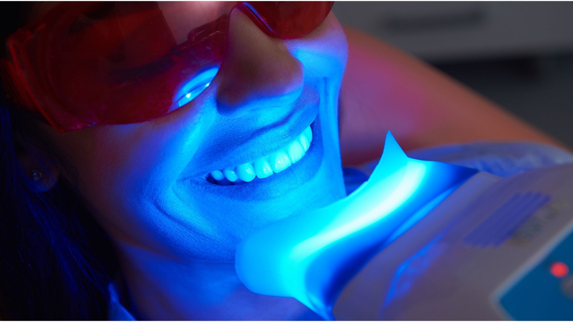 Estetica Dentale - Studio Dentistico Dott. Spatafora Alessandro